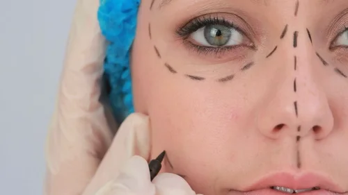 Pesadelos da Cirurgia Plástica